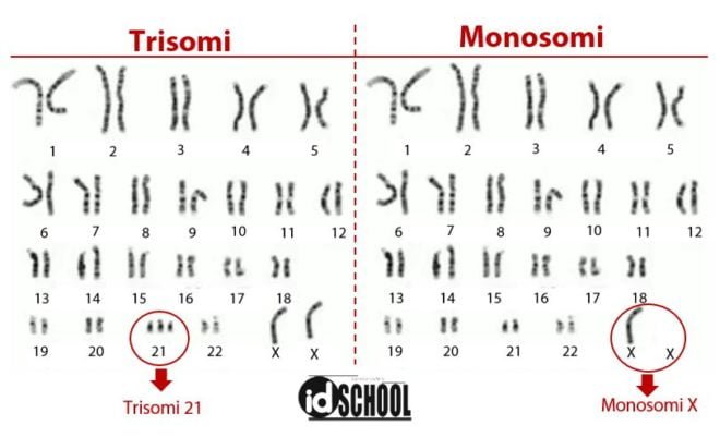 Kelainan Jumlah Kromosom Trisomi Dan Monosomi 