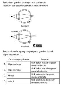 Proses Pembentukan Bayangan Pada Mata | Idschool.net