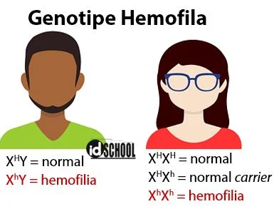 Contoh Kelainan yang Terpaut Gonosom adalah Hemofilia
