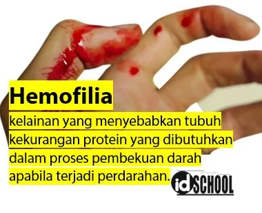 Hemofilia