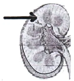 Contoh Gambar Struktur Ginjal