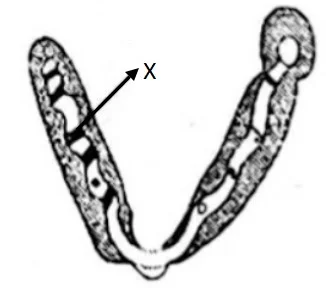 Soal Gambar Struktur Kromosom
